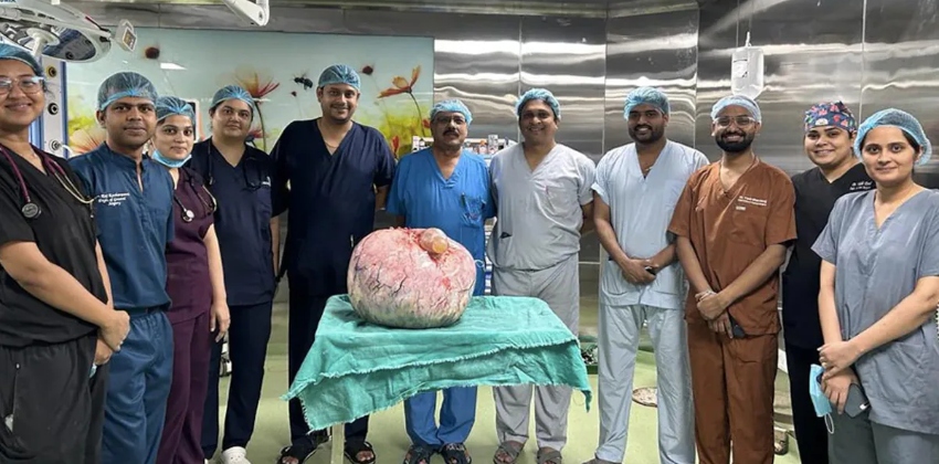 doctors-removed-15kg-tumour-from-ladys-stomach-indore