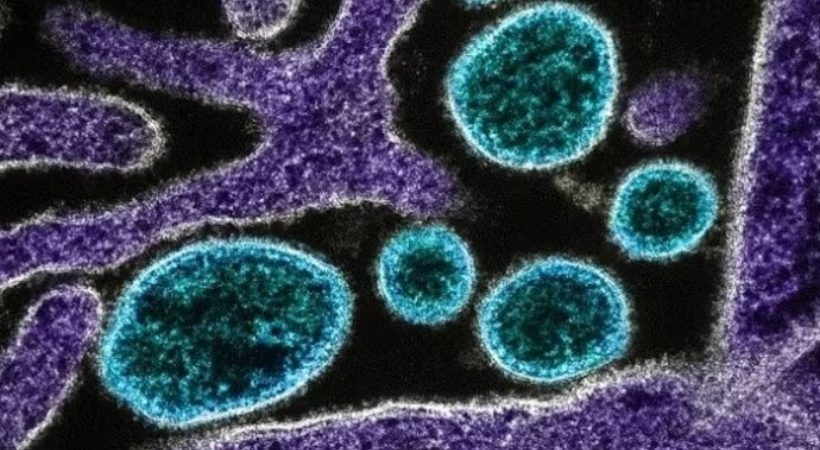 Nipah virus symptoms and prevention