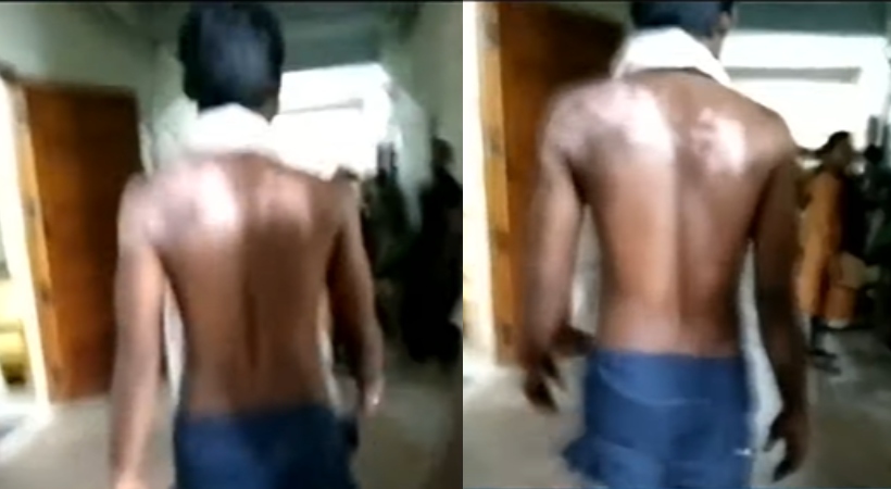 Complaint that remand prisoner was scalded by pouring hot water