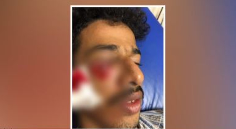 Student beaten up for posting photo on Instagram