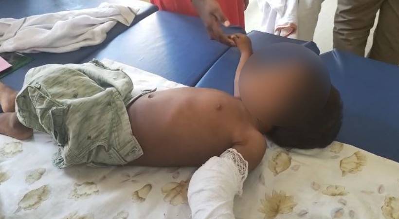 One-and-a-half-year-old boy beaten by his mother's friend
