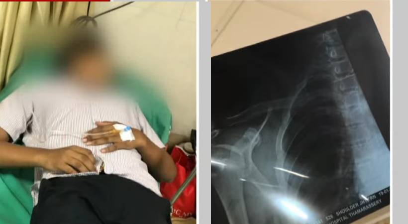 thamarassery gvhss plus one student beaten by seniors