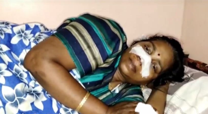 The husband assaulted his wife in tvm