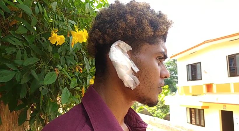 Young man was attacked and his ear bitten off