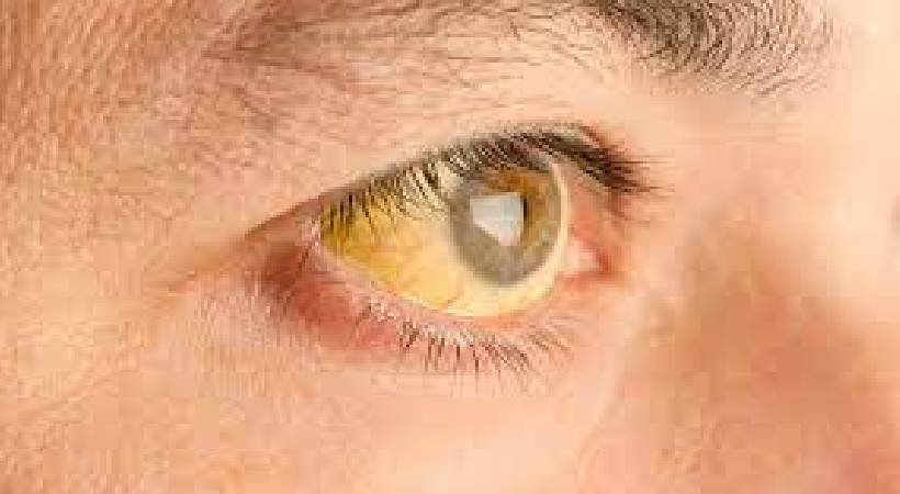 jaundice grips perumbavoor vengur