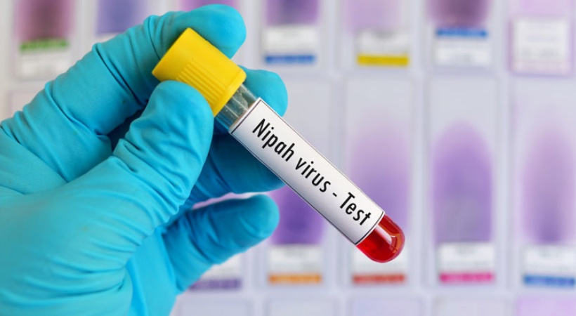 total 58 samples negative Nipah test