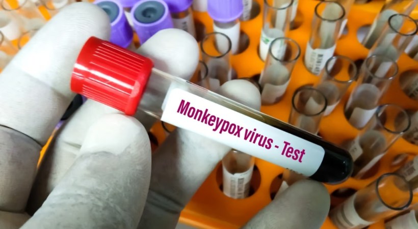 New variant of Empox confirmed in Malappuram