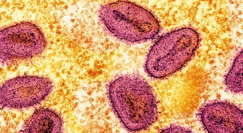 Mpox Symptoms, Causes, Treatment and Prevention