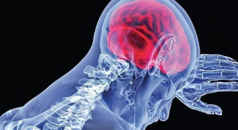 amoebic meningoencephalitis