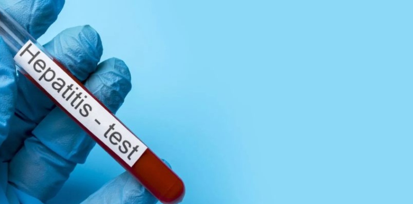hepatitis