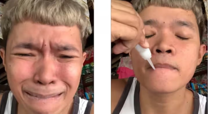 Man's Superglue Prank Goes Wrong, Seals His Lips Shut