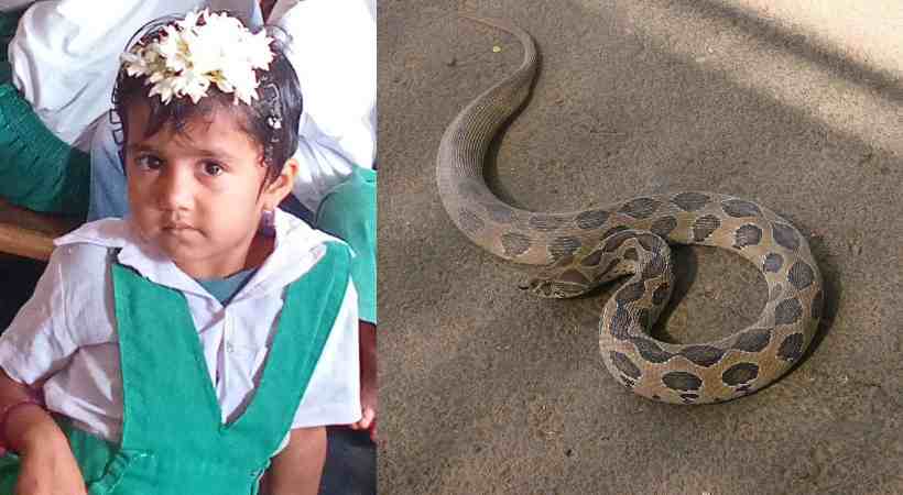 snake bite
