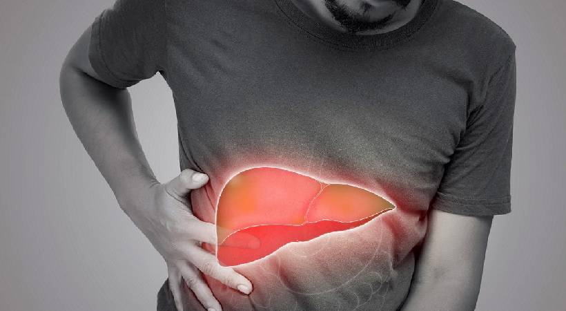 FATTY LIVER